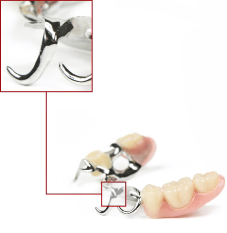 elettrolaser-dado-odontotecnico elettrolaser-dado-odontotecnico